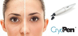 Cryotherapy (H&O Equipment CryoPen)