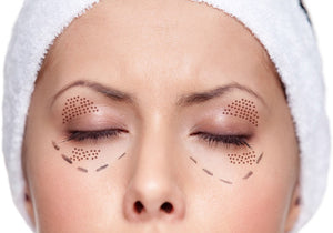 Plasma Lift (Eyelids Upper or Lower)-Beauty Bar Therapy